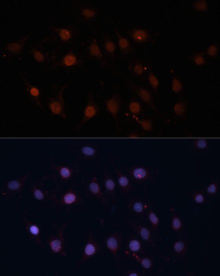 TOM70 Rabbit polyclonal antibody