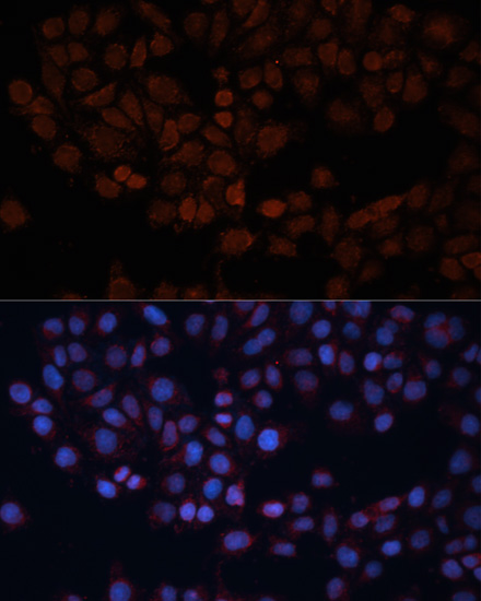 TOM70 Rabbit polyclonal antibody