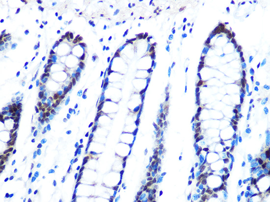 DYNLL1 Rabbit monoclonal antibody