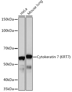 Cytokeratin 7 (KRT7) Rabbit monoclonal antibody