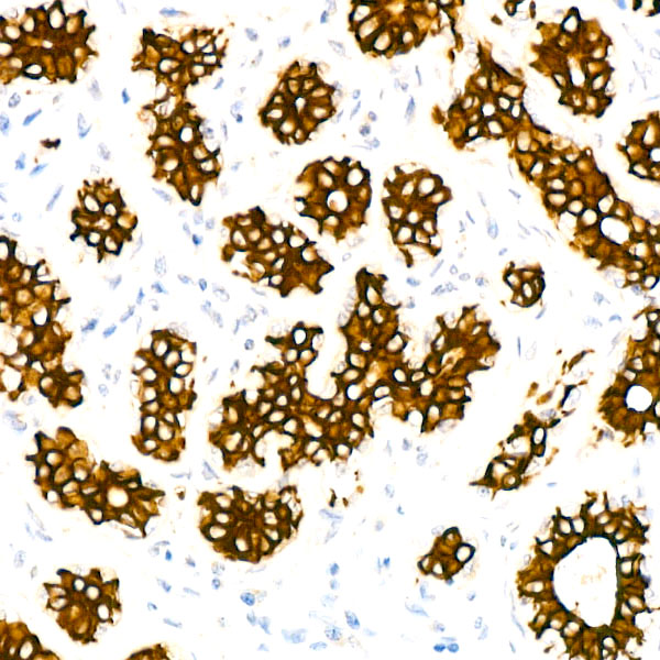 Cytokeratin 7 (KRT7) Rabbit monoclonal antibody