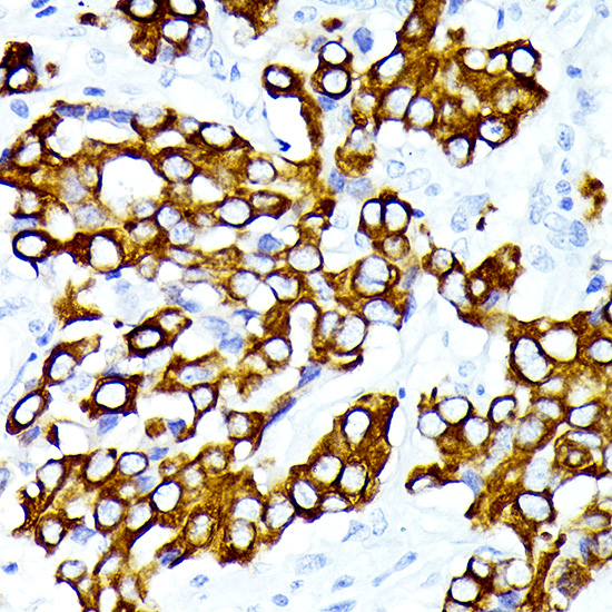Cytokeratin 7 (KRT7) Rabbit monoclonal antibody