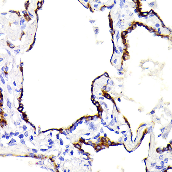 Cytokeratin 7 (KRT7) Rabbit monoclonal antibody