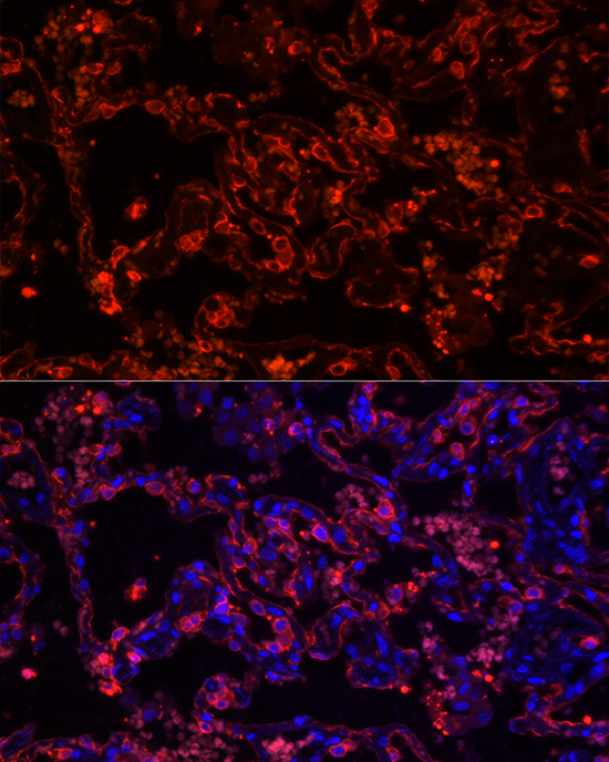Cytokeratin 7 (KRT7) Rabbit monoclonal antibody
