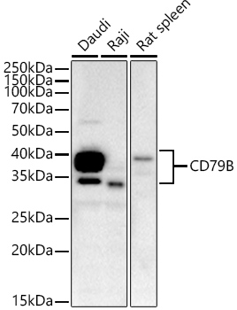 CD79B Rabbit monoclonal antibody