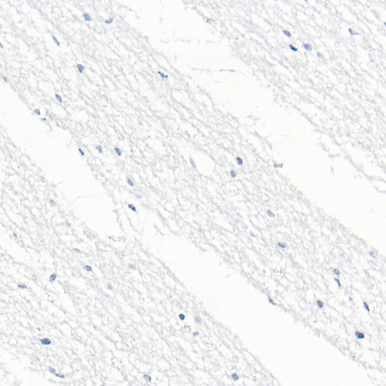 CD79B Rabbit monoclonal antibody