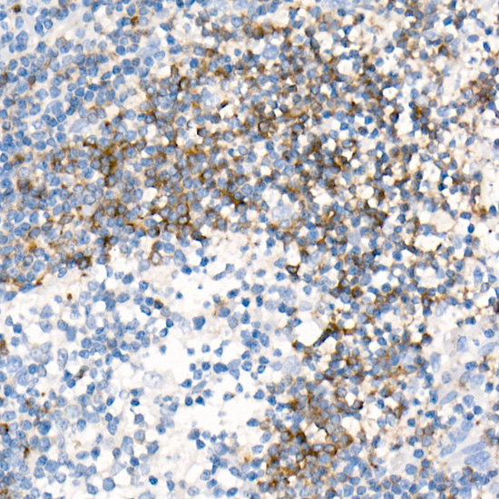 CD79B Rabbit monoclonal antibody