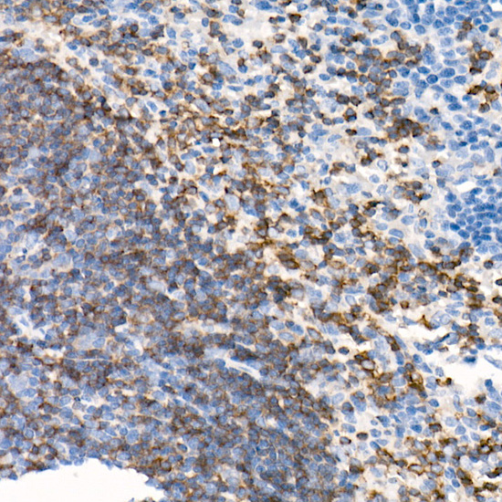 CD79B Rabbit monoclonal antibody