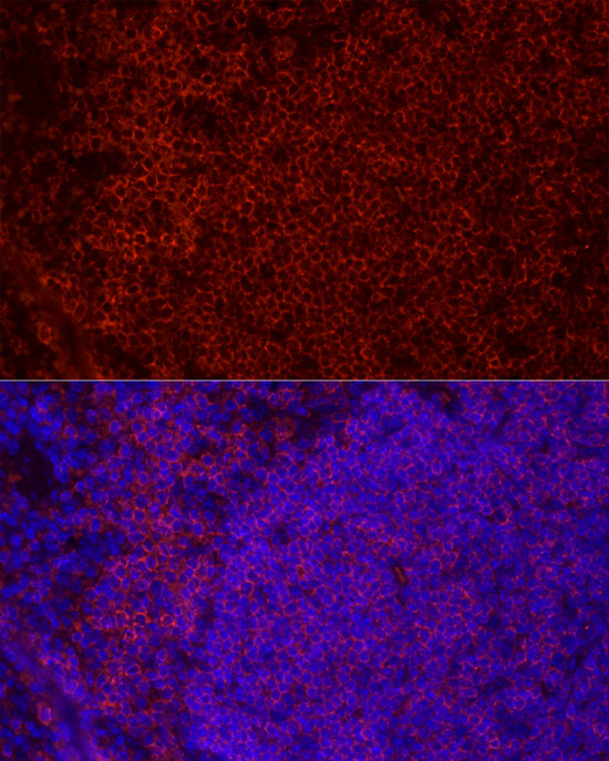 CD79B Rabbit monoclonal antibody