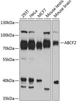 ABCF2 Rabbit polyclonal antibody