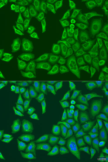 ABCF2 Rabbit polyclonal antibody