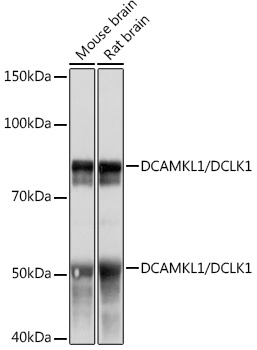 DCAMKL1/DCLK1 Rabbit mAb