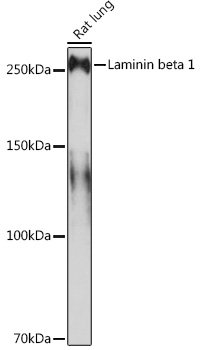 Laminin beta 1 Rabbit monoclonal antibody