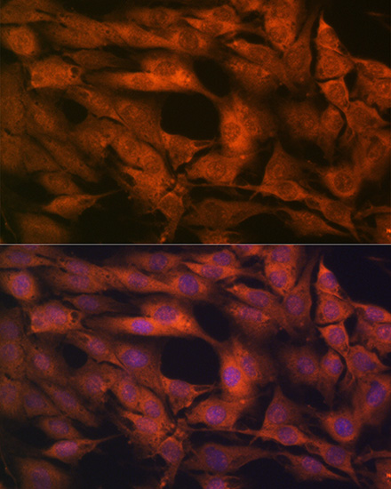 Laminin beta 1 Rabbit monoclonal antibody