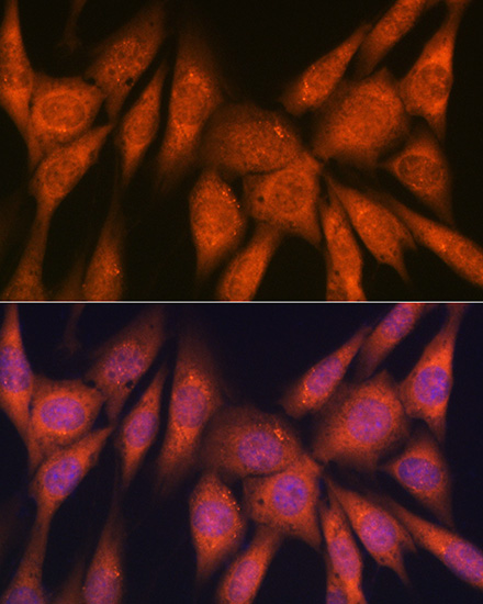 Laminin beta 1 Rabbit monoclonal antibody