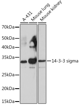 14-3-3 sigma Rabbit monoclonal antibody