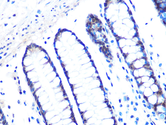 14-3-3 sigma Rabbit monoclonal antibody