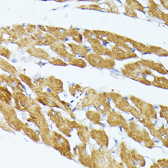 TRAP1 Rabbit polyclonal antibody