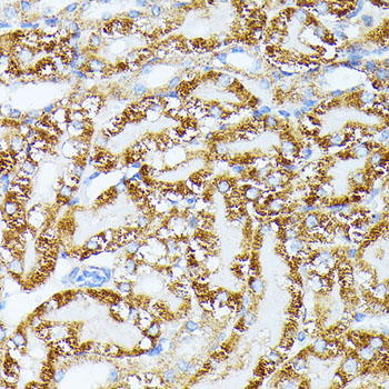TRAP1 Rabbit polyclonal antibody