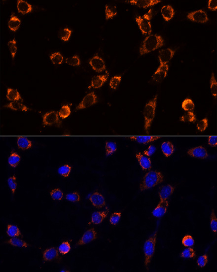 TRAP1 Rabbit polyclonal antibody