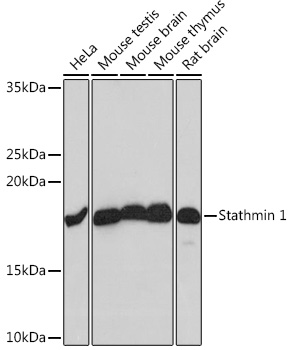 Stathmin 1 Rabbit monoclonal antibody
