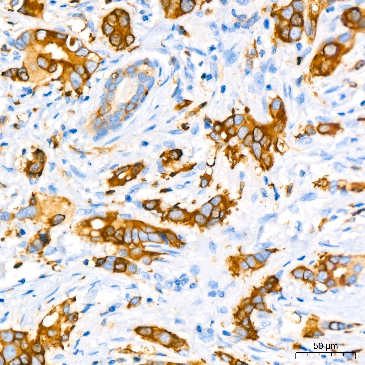 Stathmin 1 Rabbit monoclonal antibody