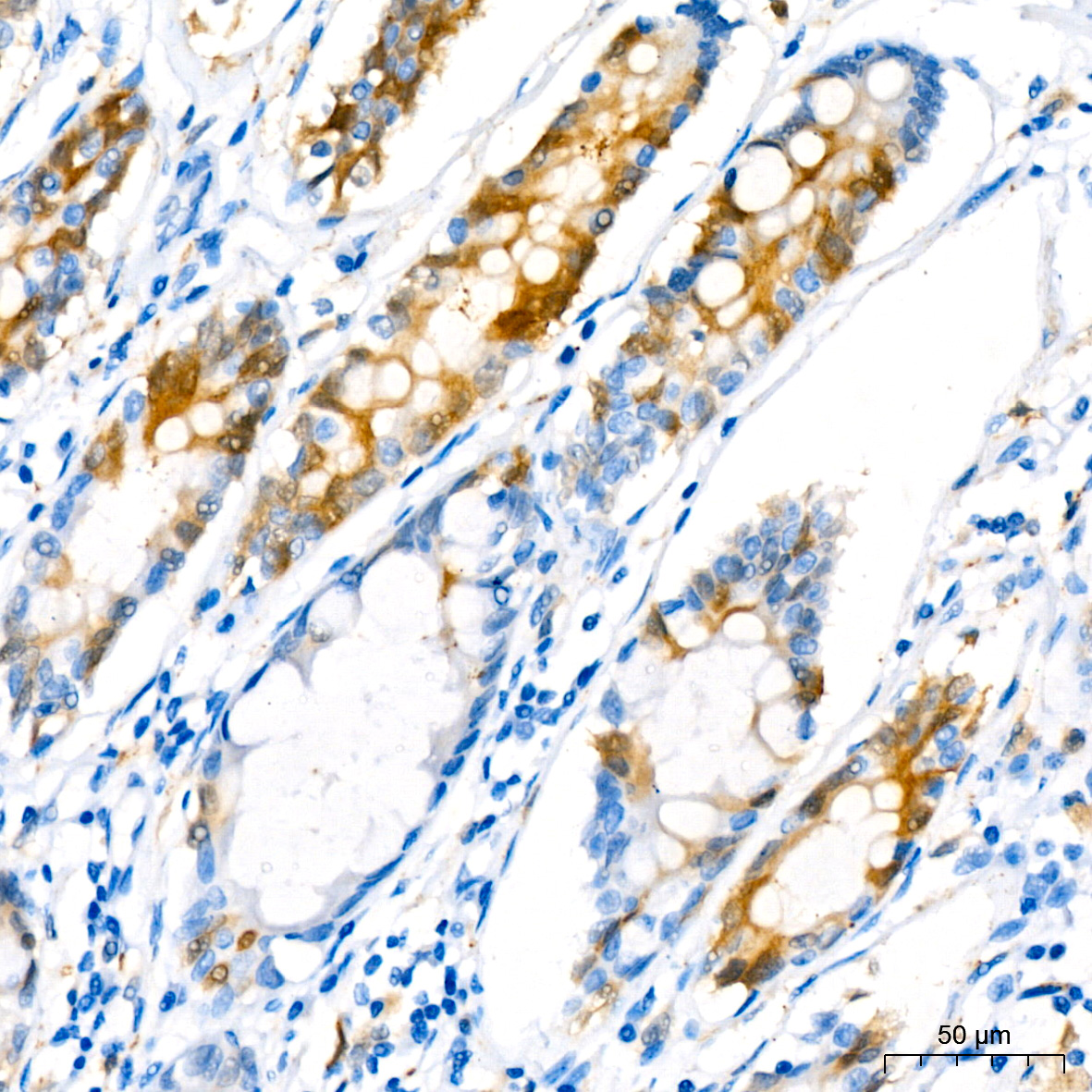 Stathmin 1 Rabbit monoclonal antibody