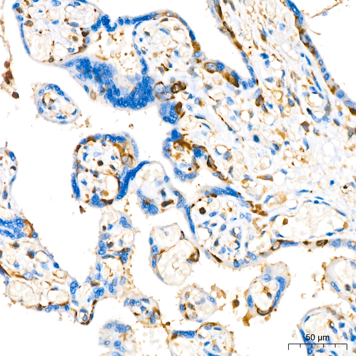 Stathmin 1 Rabbit monoclonal antibody