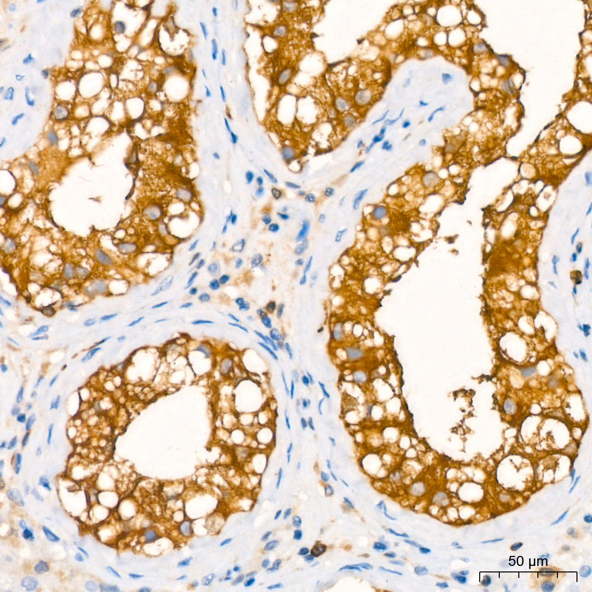 Stathmin 1 Rabbit monoclonal antibody