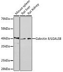 Western blot - Galectin 8/LGALS8 Rabbit mAb (A4383)
