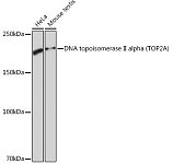 Western blot - DNA topoisomerase II alpha (TOP2A) Rabbit mAb (A4389)