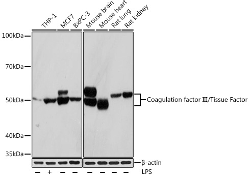 Coagulation factor III/Tissue Factor Rabbit mAb