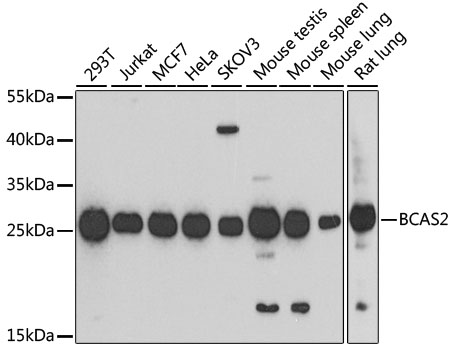 BCAS2 Rabbit polyclonal antibody