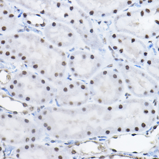 BCAS2 Rabbit polyclonal antibody