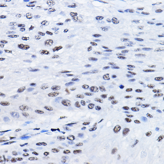 BCAS2 Rabbit polyclonal antibody