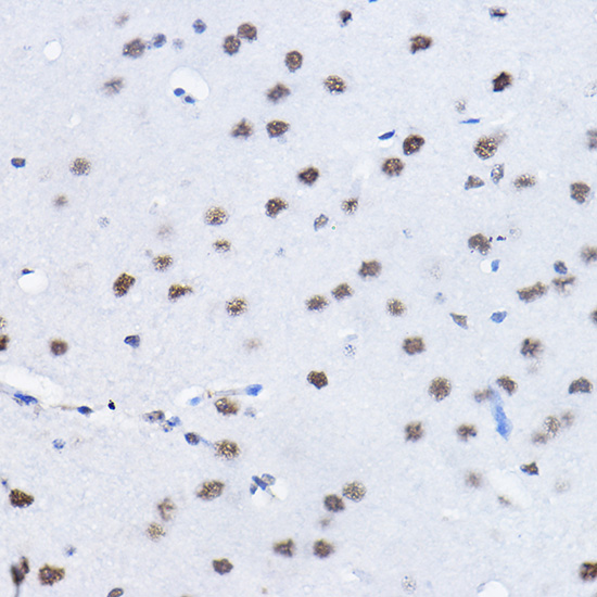BCAS2 Rabbit polyclonal antibody