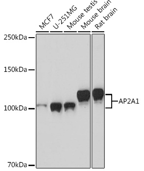 AP2A1 Rabbit monoclonal antibody