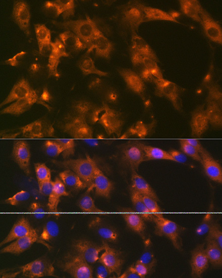 AP2A1 Rabbit monoclonal antibody