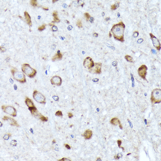 BNIP1 Rabbit monoclonal antibody