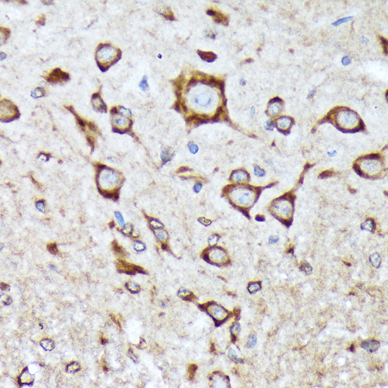 BNIP1 Rabbit monoclonal antibody