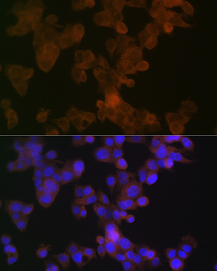 APOL1 Rabbit monoclonal antibody