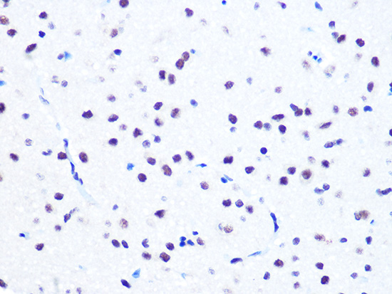 NUMA1 Rabbit monoclonal antibody