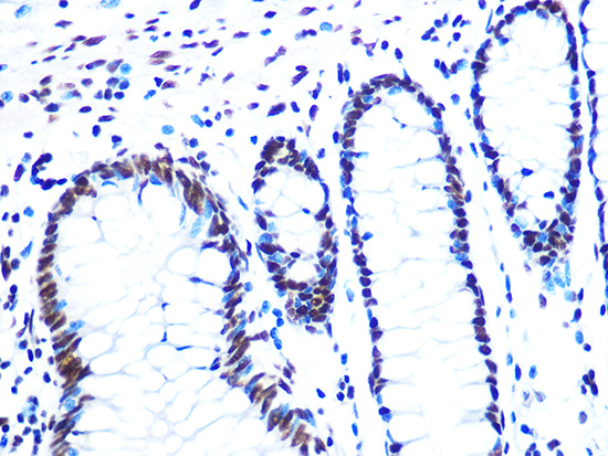 NUMA1 Rabbit monoclonal antibody