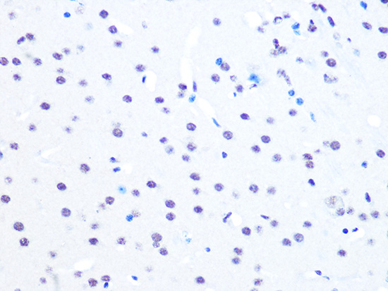 NUMA1 Rabbit monoclonal antibody