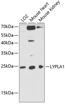 LYPLA1 Rabbit polyclonal antibody