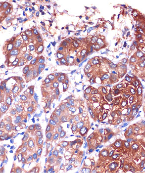 LYPLA1 Rabbit polyclonal antibody