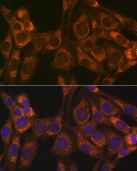 Thioredoxin 2 (Trx2/TXN2) Rabbit monoclonal antibody