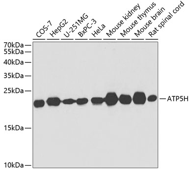 ATP5H Rabbit polyclonal antibody