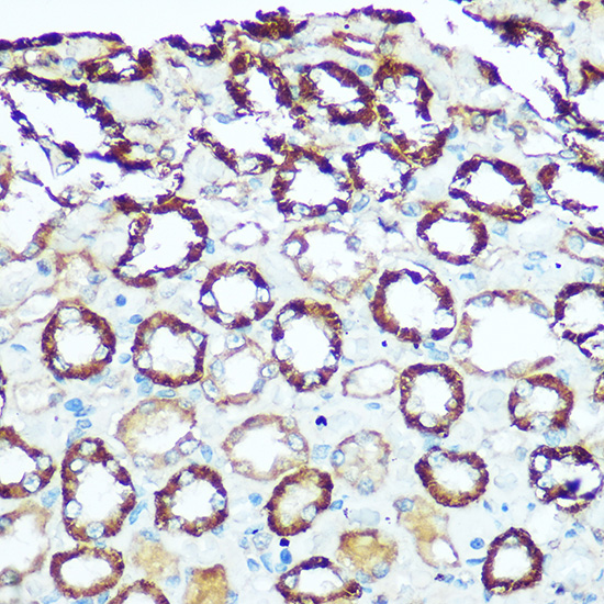 ATP5H Rabbit polyclonal antibody