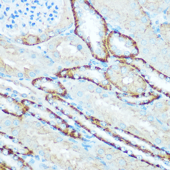 ATP5H Rabbit polyclonal antibody